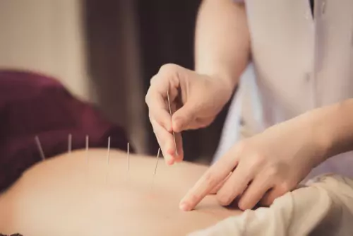 Professional Medical Acupuncture