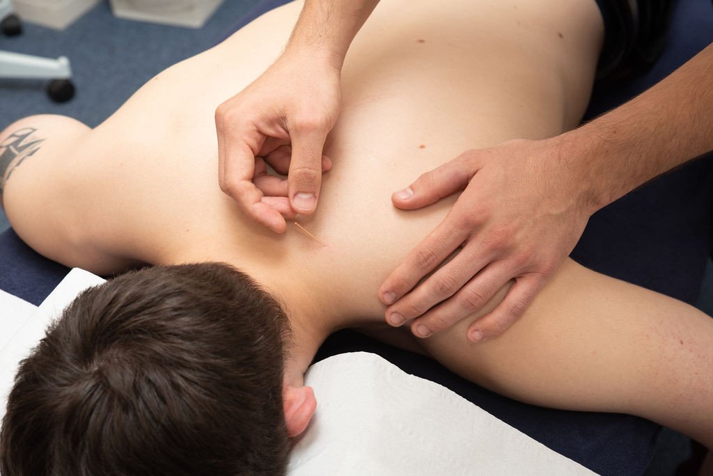 What can Acupuncture help to treat?